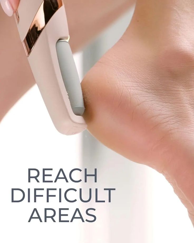 Electric Foot Callus Remover – Rechargeable Pedicure File for Dead Skin, Cracked Heels & Smooth Feet