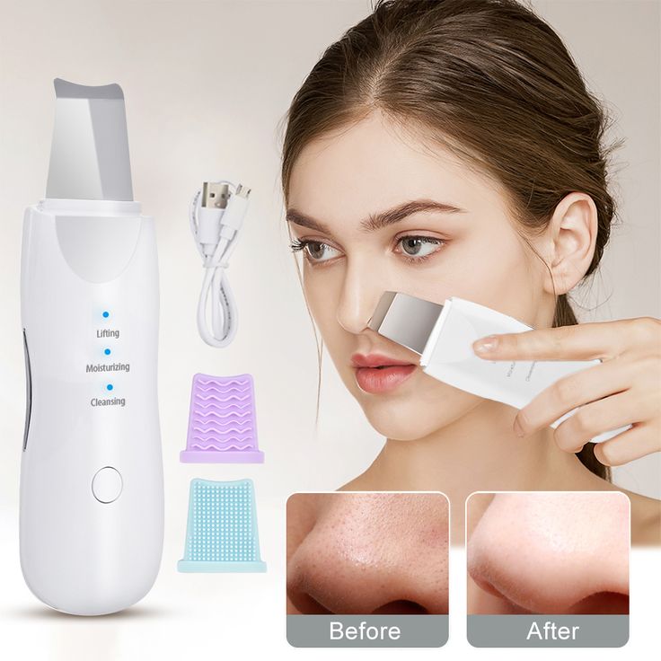 Ultrasonic Blackhead Removal Device – Rechargeable Skin Scrubber & Deep Cleansing Facial Cleaner