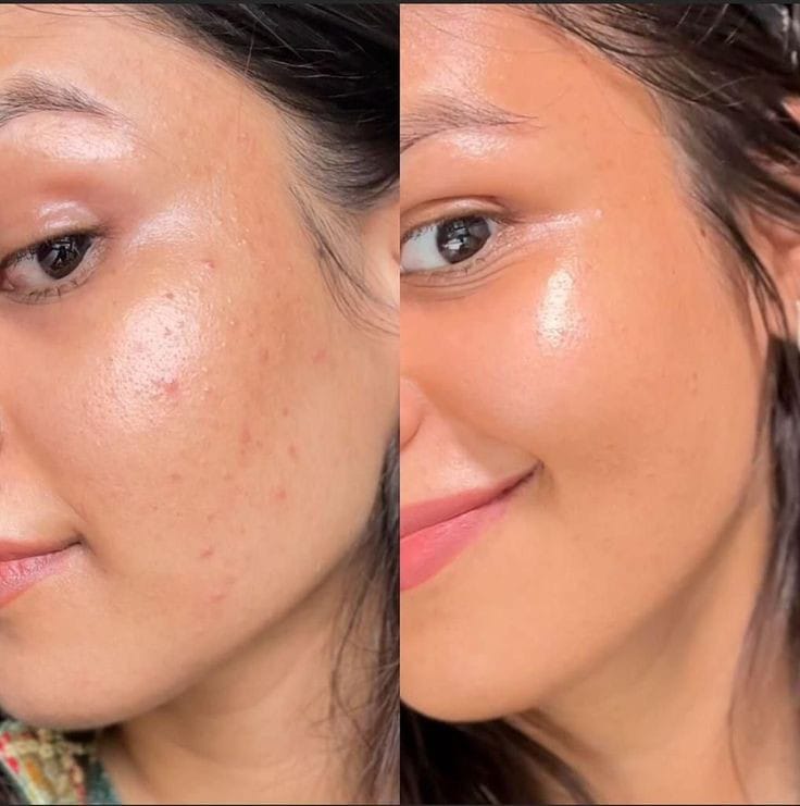 Skin Polish Kit - Fusion Auraarabic-aura-watch-side-view